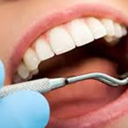 Dental Exams Cleanings